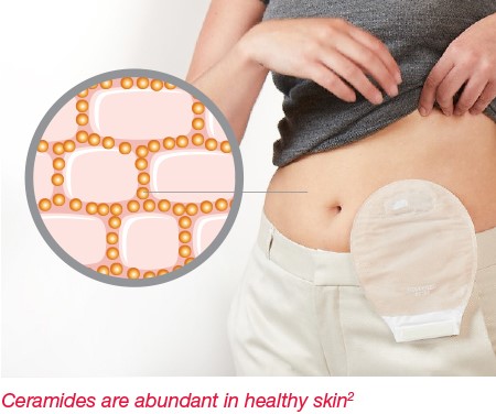 Ostomy Barrier